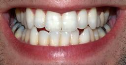 Dentition d'adulte. Source : http://data.abuledu.org/URI/533728bc-dentition-d-adulte